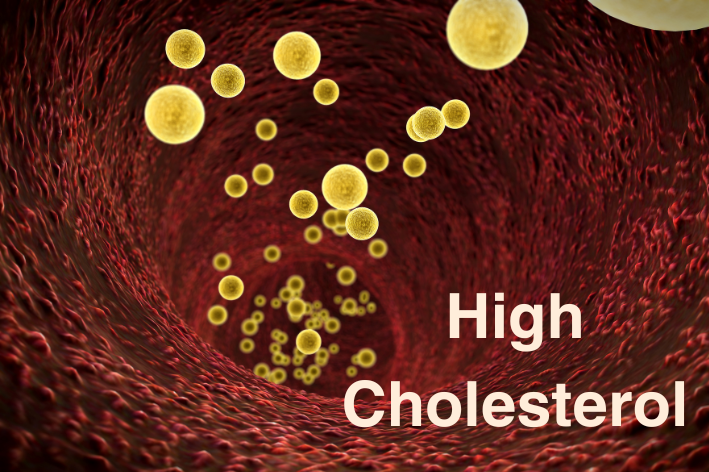 high cholestrol