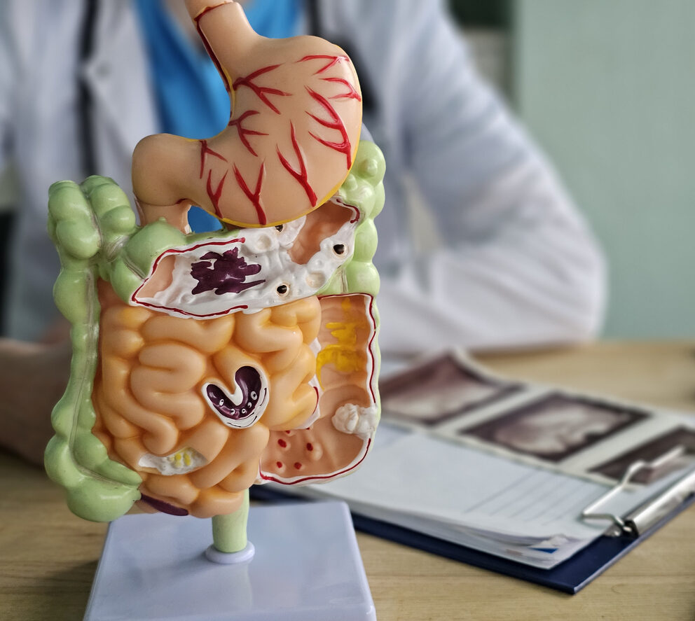Model of human digestive system displayed on a table in a medical office during a consultation concept
